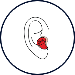 In-the-Canal (ITC) hearing aid